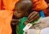 Test de malnutrition sur un enfant en Somalie