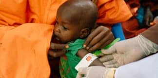 Test de malnutrition sur un enfant en Somalie