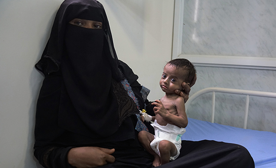 Iêmen enfrenta a pior crise humanitária do mundo que deixou mais de 24 milhões de pessoas sem assistência e proteção.