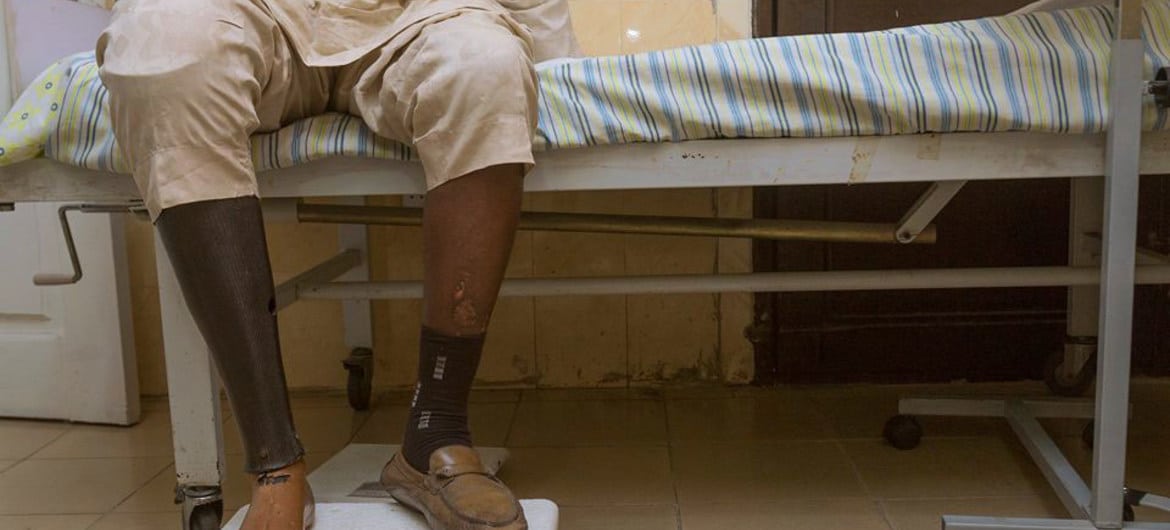 Paciente diabético na Nigéria precisou ter o pé amputado. 