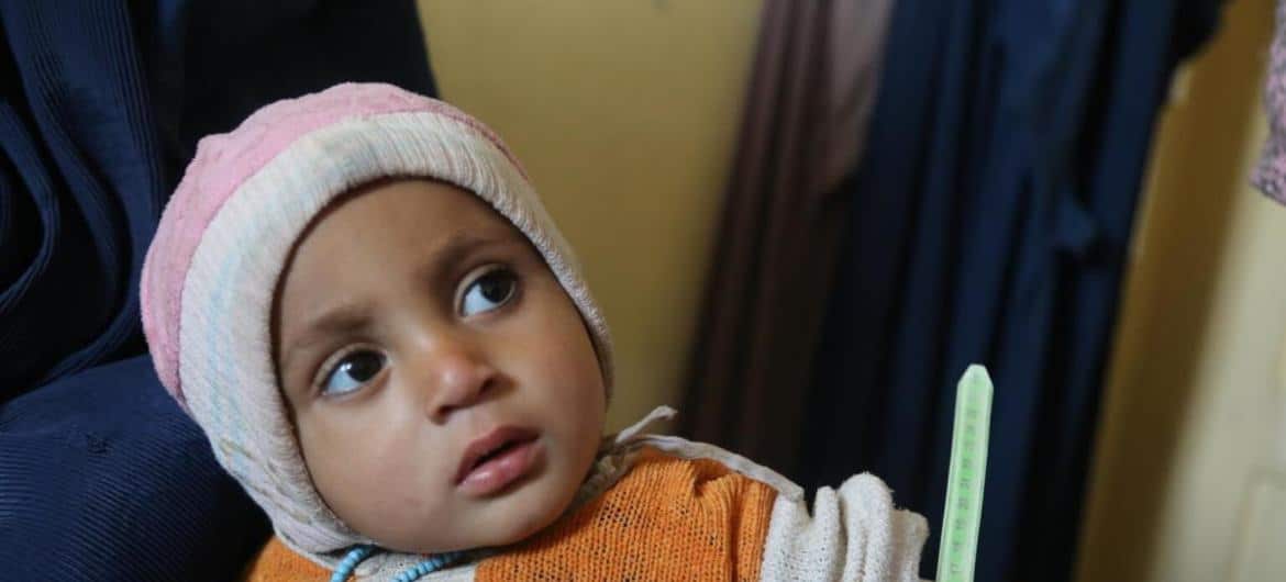 Menino tem circunferência do braço medida em Kandahar, Afeganistão